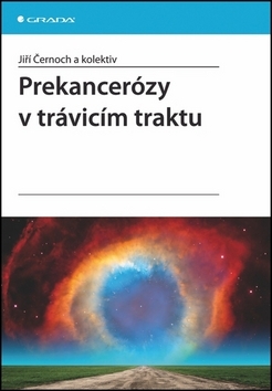 Prekancerózy trávicím traktu - Jiří Černoch,Kolektív autorov