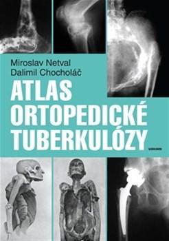 Atlas ortopedické tuberkulózy - Dalimil Chocholac