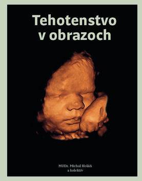 Tehotenstvo v obrazoch - MUDr. Michal Holáň,Kolektív autorov