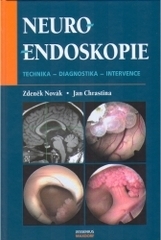 Neuroendoskopie - Zdeněk Novák