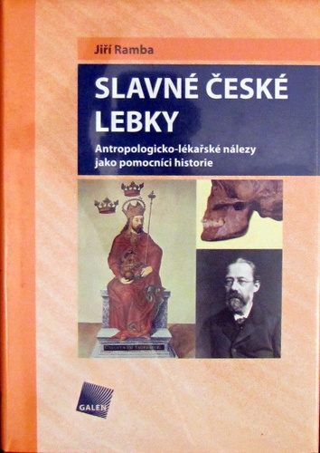 Slavné české lebky