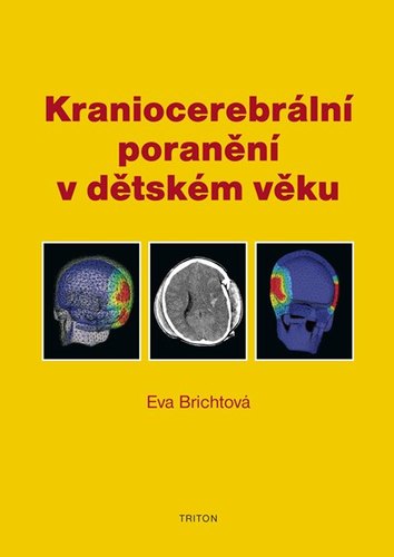 Kraniocerebrální poranění v dětském věku