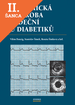 Lacná kniha Ischemická choroba srdeční