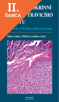 Lacná kniha Neuroendokrinní nádory trávicí