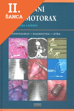 Lacná kniha Spontánní pneumotorax