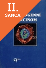 Lacná kniha Bronchogenní karcinom