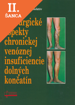 Lacná kniha Chirurgické aspekty chronickej venóznej insuficiencie dolných končatín