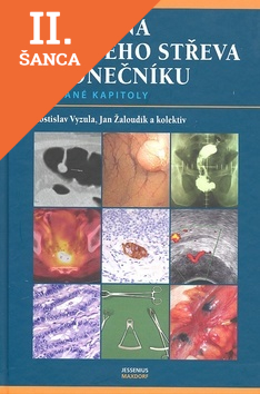 Lacná kniha Rakovina tlustého střeva a konečníku