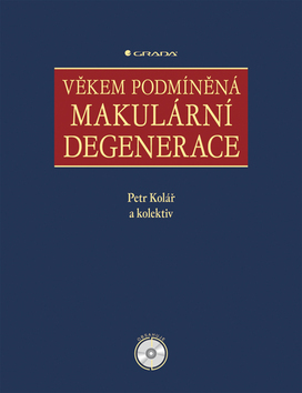 Věkem podmíněná makulární degenerace