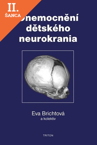 Lacná kniha Onemocnění dětského neurokrania