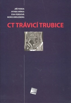 CT Trávicí trubice