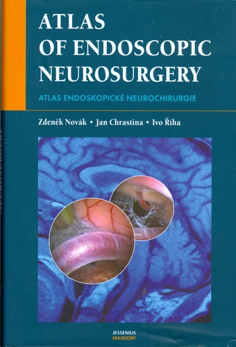 Kniha Atlas endoskopické neurochirurgie - Pavel Chrastina,Zdeněk Novák,Ivo Říha