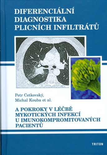 Diferenciální diagnostika plicních infiltrátů - Petr Cetkovský