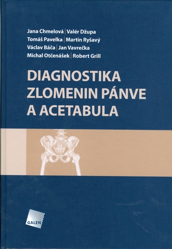 Diagnostika zlomenin pánve a acetabula