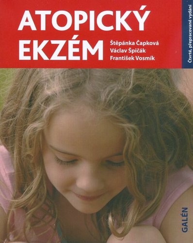 Atopický ekzém
