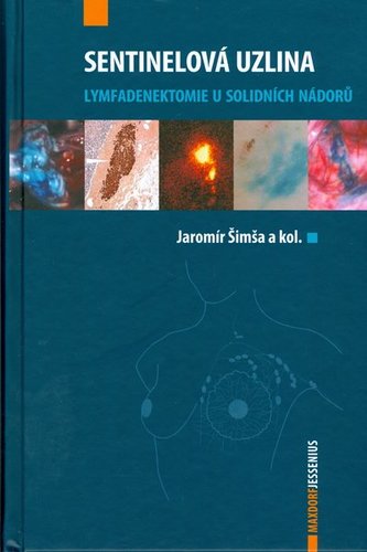 Kniha Sentinelová uzlina - Kolektív autorov,Jaromír Šimša