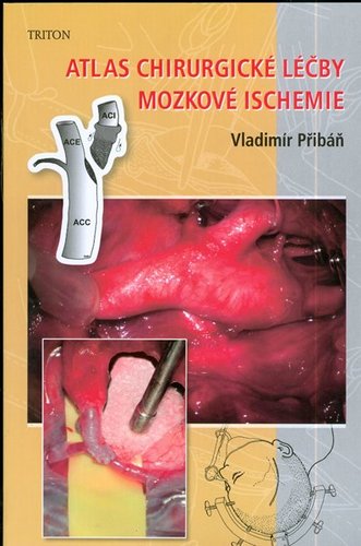 Kniha Atlas chirurgické léčby mozkové ischemie - Vladimír Přibáň