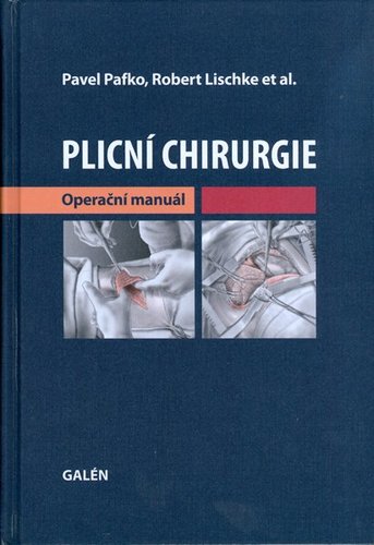 Plicní chirurgie - Kolektív autorov,Pavel Pafko