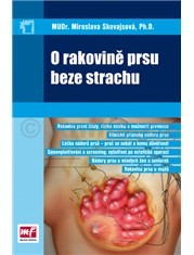 O rakovině prsu beze strachu