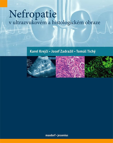 Nefropatie v ultrazvukovém a histologickém obraze - Kolektív autorov