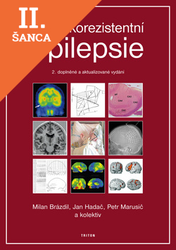 Lacná kniha Farmakorezistentní epilepsie