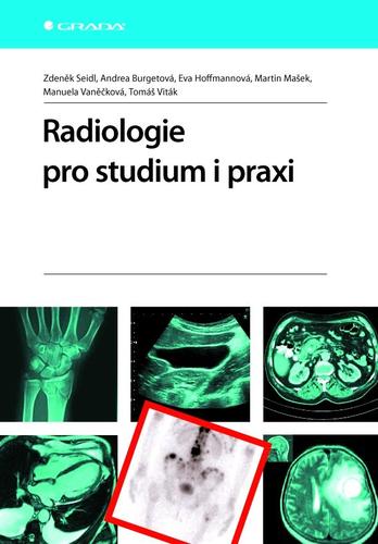Kniha Radiologie pro studium i praxi
