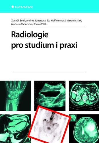 Radiologie pro studium i praxi - Zdeněk Seidl,Kolektív autorov