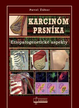 Kniha Karcinóm prsníka - Pavol Žúbor