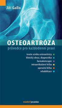 Kniha Osteoartróza