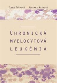 Chronická myelocytová leukémia - Adriana Kafková,Elena Tóthová