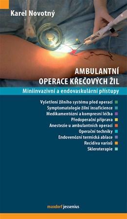 Ambulantní operace křečových žil - Karel Novotný