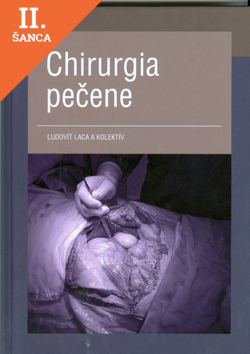 Lacná kniha Chirurgia pečene