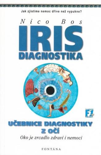 Irisdiagnostika