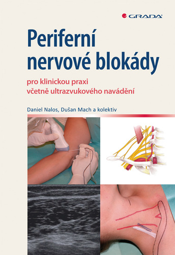 Periferní nervové blokády pro klinickou praxi včetně ultrazvukového navádění
