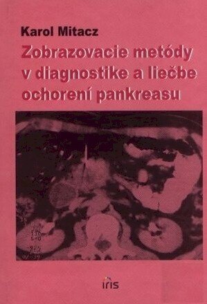 Zobrazenie metódy v diagnostike a liečbe ochorení pankreasu