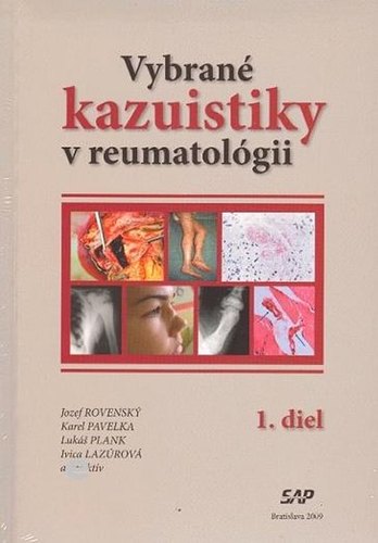 Vybrané kauzistiky v reumatológii 1-2 diel - Jozef Rovenský