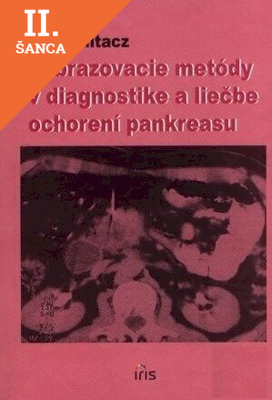 Lacná kniha Zobrazenie metódy v diagnostike a liečbe ochorení pankreasu
