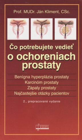 Čo potrebujem vedieť o ochoreniach prostaty