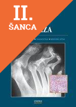 Lacná kniha Psoriatická artridida a psoriáza
