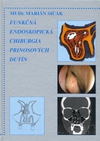 Funkčná endoskopická chirurgia prínosových dutín