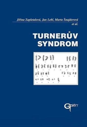 TURNERUV SYNDROM