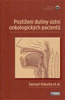 Postižení dutiny ústní onkologických pacientů - Kolektív autorov,Samuel Vokurka