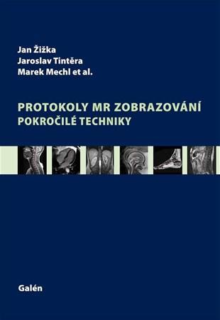 Kniha Protokoly MR zobrazování. Pokročilé techniky - Kolektív autorov