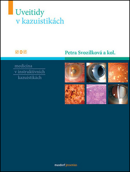 Uveitidy v kazuistikách
