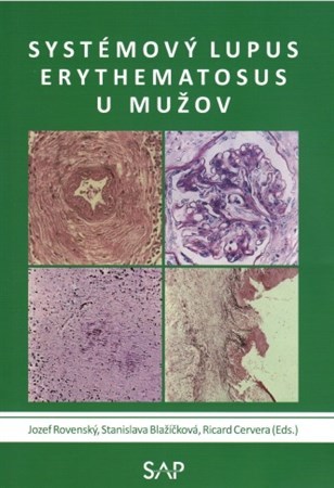 Systémový lupus erythematosus u mužov - Jozef Rovenský