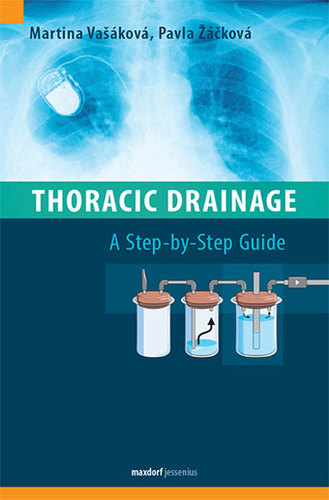 Kniha Thoracic Drainage / A Step-by-Step Guide
