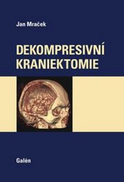 Kniha Dekompresivní kraniektomie - Jan Mraček