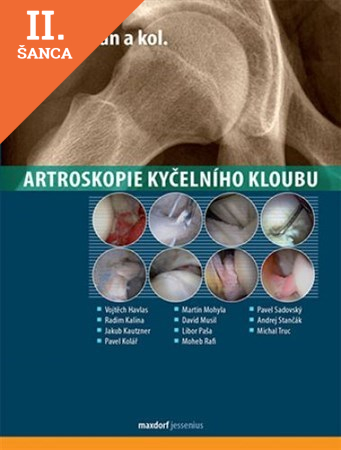 Lacná kniha Artroskopie kyčelního kloubu