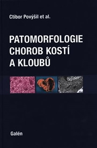 Kniha Patomorfologie chorob kostí a kloubů
