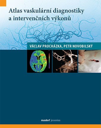 Atlas vaskulární diagnostiky a intervenčních výkonů - Václav Procházka